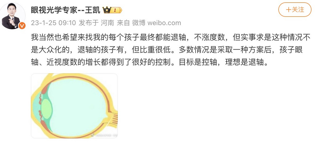 离焦镜佩戴1年复查结果竟是？！奶爸亲身讲述最伤眼的4个行为